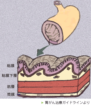 胃の断面のイメージ